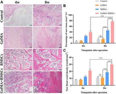 Biomimetic Methacrylated Gelatin Hydrogel Loaded With Bone Marrow Mesenchymal Stem Cells for Bone Tissue Regeneration